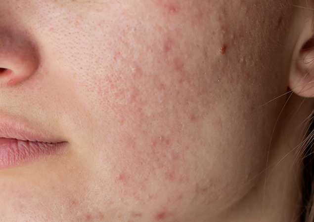 before skin treatment