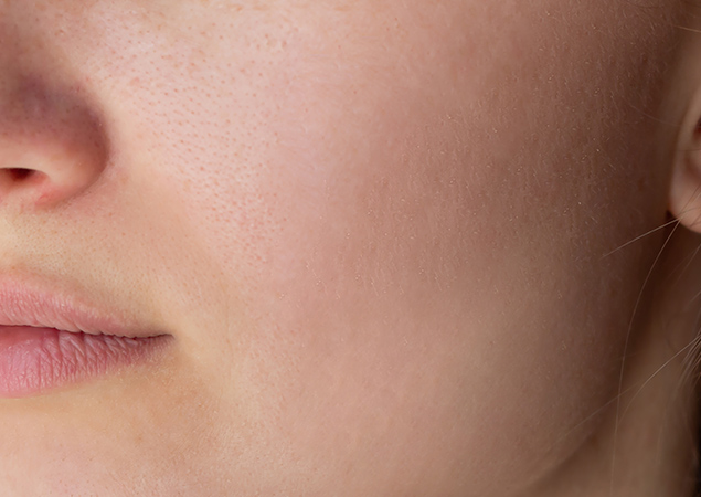 after skin treatment in aesthetic aura