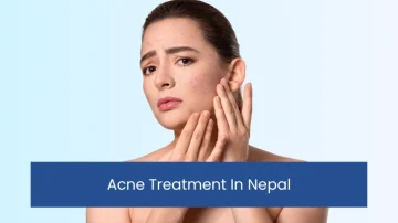 Acne Treatment In Nepal, Kathmandu