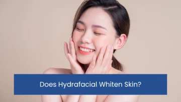 Young woman with glowing skin smiles, gently touching her cheeks. The text "Does Hydrafacial Whiten Skin?" is displayed on a blue banner below.