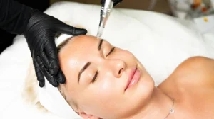microneedling treatment in nepal