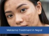 Melasma Treatment in Nepal