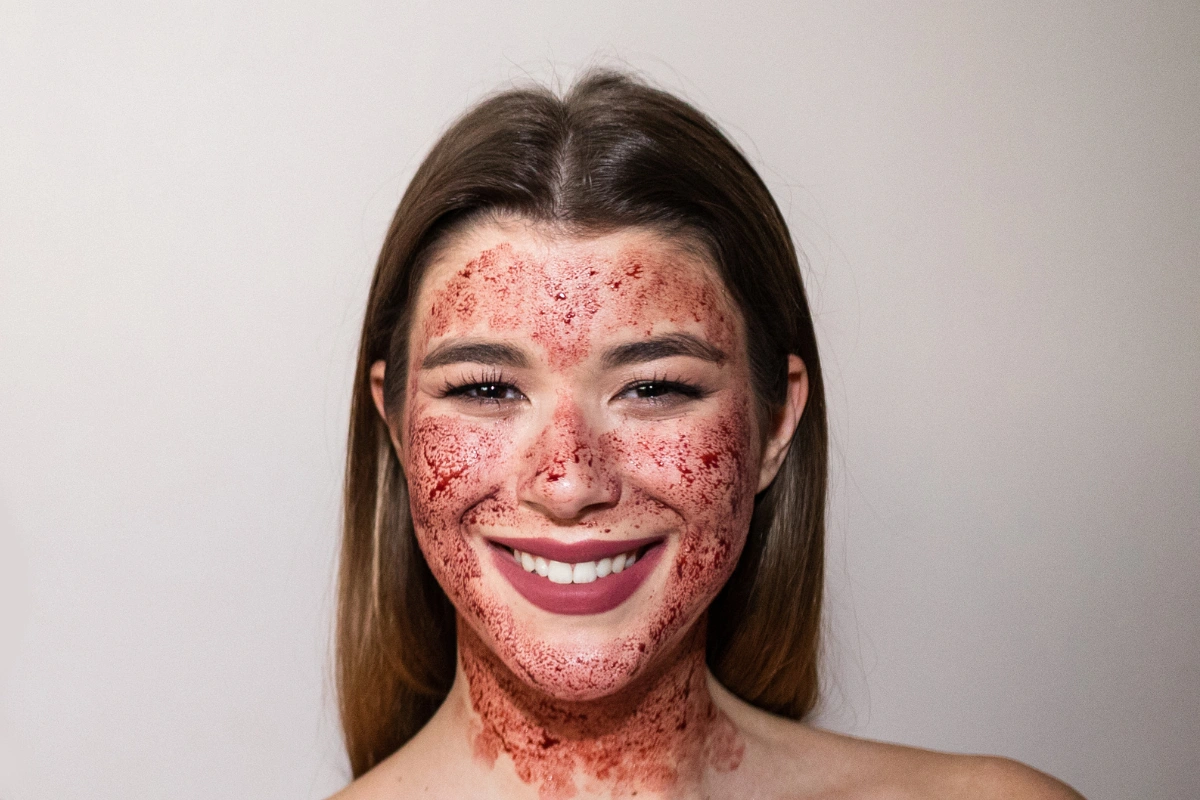 Happy customer after Vampire Facial in Nepal