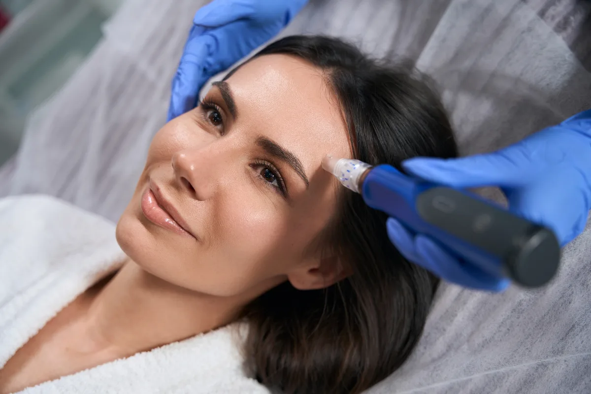 Microneedling in Nepal