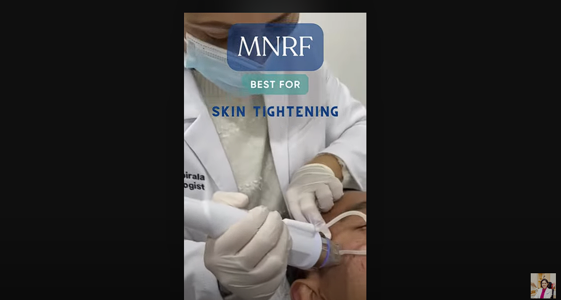 Microneedling in Nepal