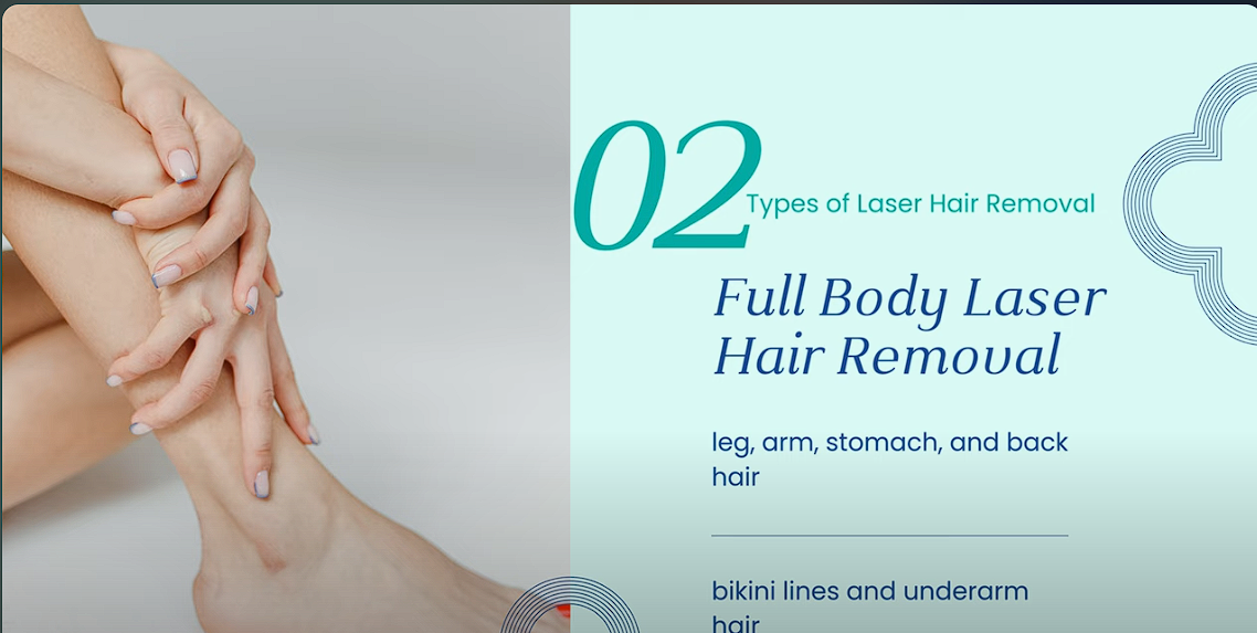 laser hair removal result