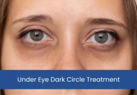 Under Eye Dark Circle Treatment