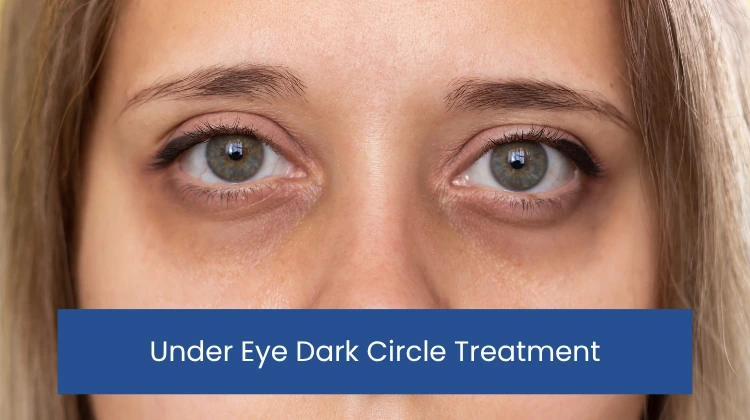 Under Eye Dark Circle Treatment