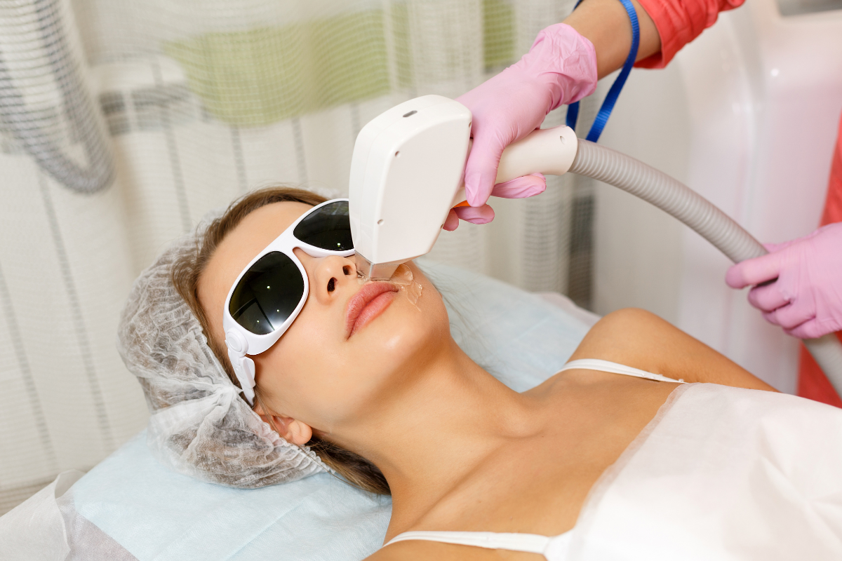 laser hair removal in nepal