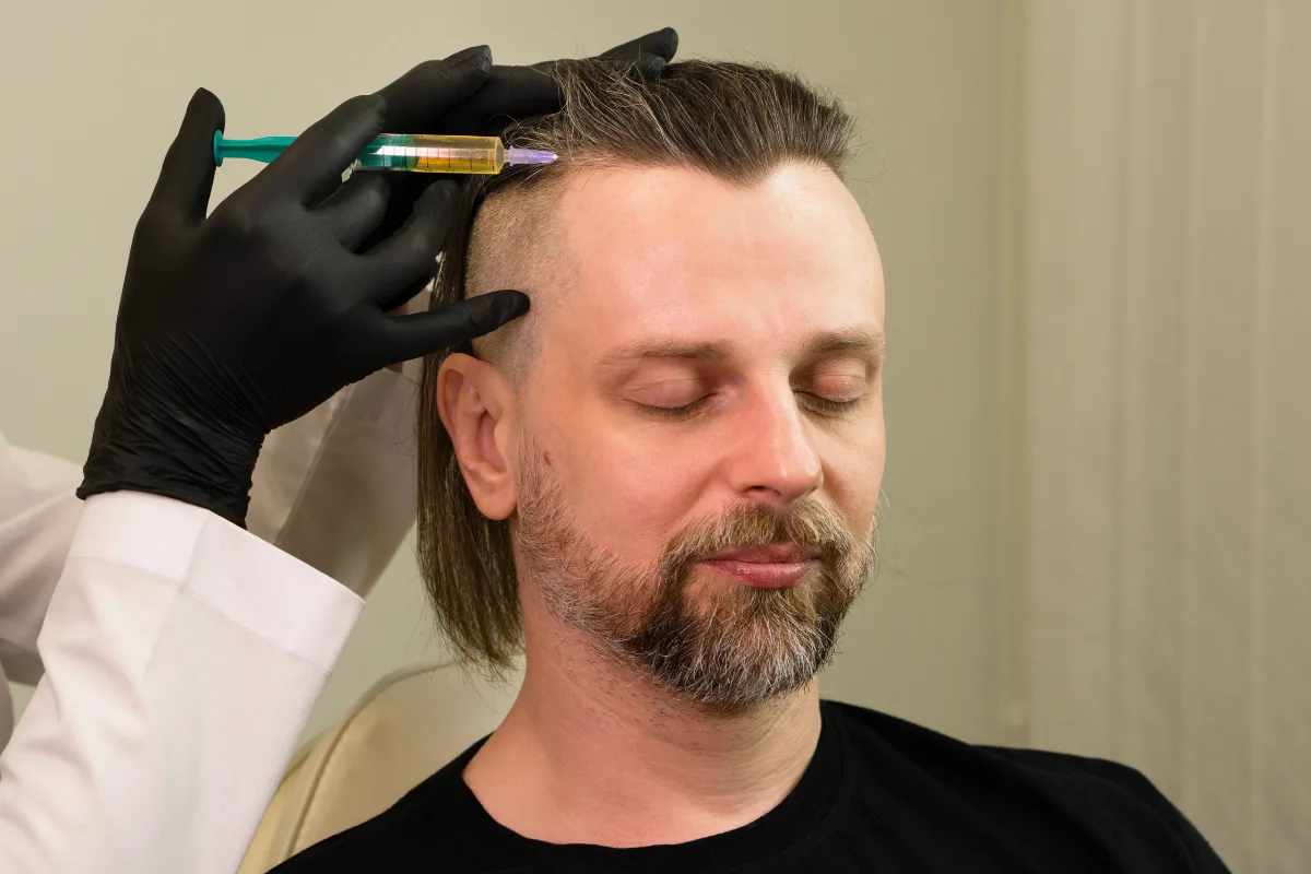 man having prp treatment in kathmandu