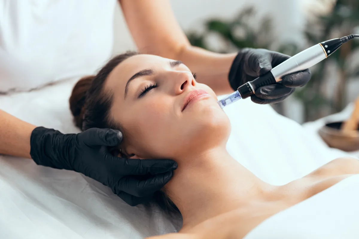 women having microneedling treatment from best doctor in kathmandu