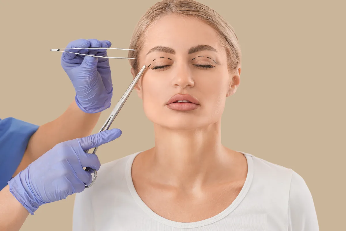 Eyelid Surgery in kathmandu nepal