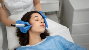 Patient undergoing microneedling procedure for hyperpigmentation