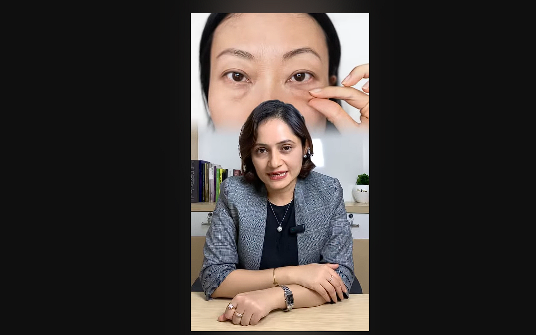 eyebags removal tips from dr. Isha, best skin doctor in kathmandu