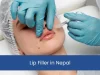 lip filler in nepal, lip fillers in nepal kathmandu