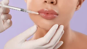 women having lip filler treatment in kathmandu nepal