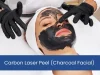 Charcoal Facial or Carbon Laser Peel in kathmandu
