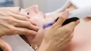 doctor performing mnrf treatment in kathmandu nepal