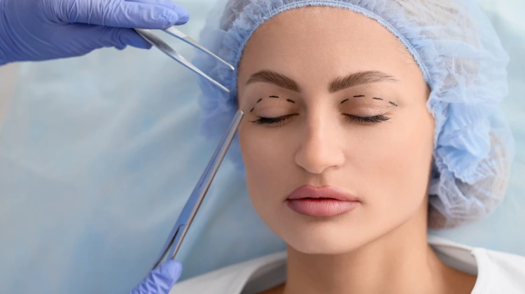blepharoplasty eye surgery