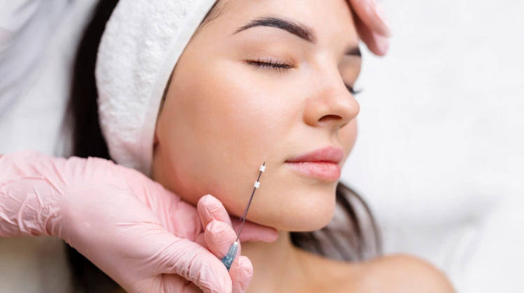 innovative technique of New thread lift in nepal