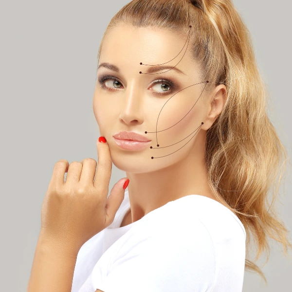 thread lift , nonsurgical procedure, lower facelift