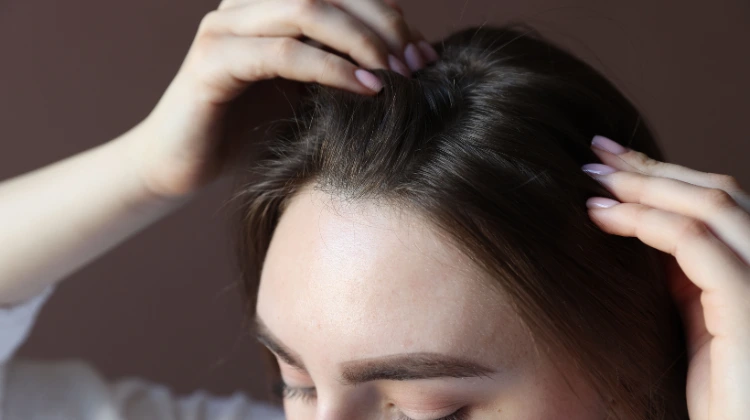 hair transplant result in women